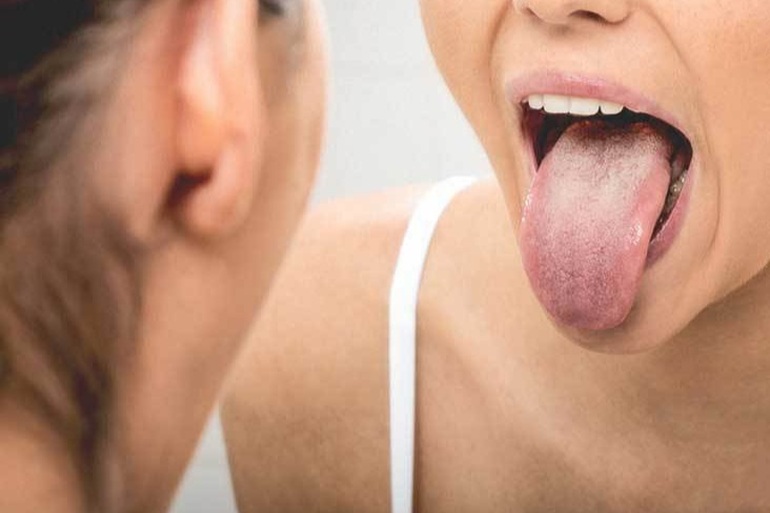 6 nguyên nhân gây ung thư lưỡi bạn dễ dàng bỏ qua - 1