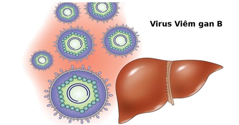 Những điều cần biết về viêm gan B và ung thư gan - 1 Những điều cần biết về viêm gan B và ung thư gan - 1
