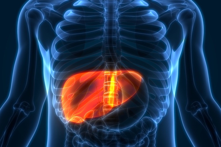 Ghép gan có được sử dụng làm phương pháp chữa trị u gan không?
