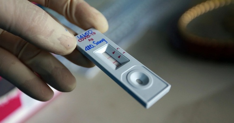 Loạn giá kit test xét nghiệm SARS-CoV-2, Bộ Y tế nói gì?