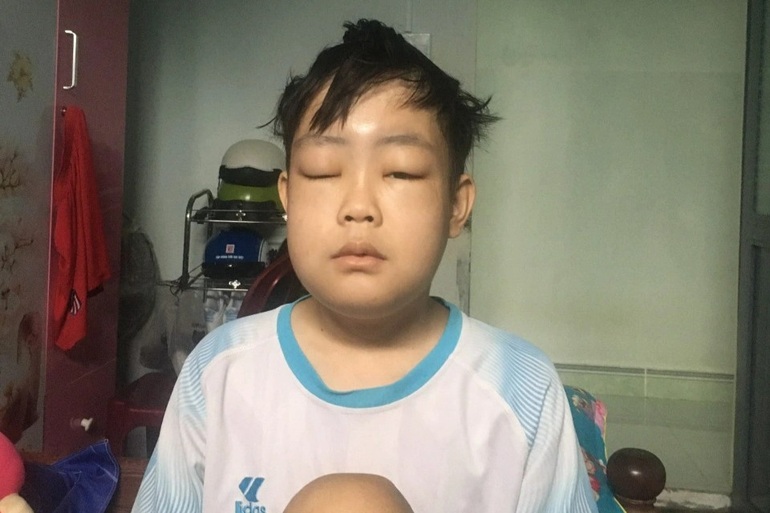 Người mẹ nghèo cay đắng bán từng củ gừng mong cứu con ung thư - 6 Người mẹ nghèo cay đắng bán từng củ gừng mong cứu con ung thư - 6