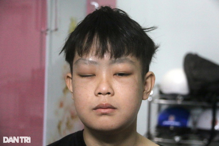 Người mẹ nghèo cay đắng bán từng củ gừng mong cứu con ung thư - 2 Người mẹ nghèo cay đắng bán từng củ gừng mong cứu con ung thư - 2