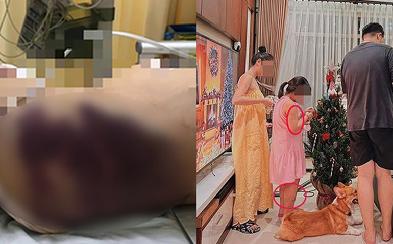 Vụ bé gái bị bạo hành đến tử vong: Hà Anh xin lỗi vì hoài nghi mẹ cháu bé