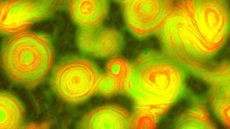 Bất ngờ phát hiện hình ảnh vi khuẩn đột biến đẹp như tranh của Van Gogh - 1