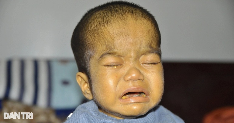 Cậu bé vàng như củ nghệ Duy Anh đã mãi mãi ra đi - 1