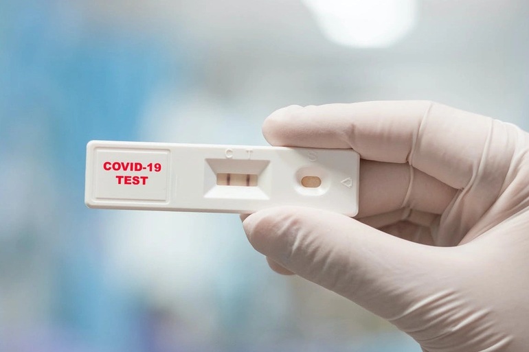 Nhiều người dân không khai báo khi kết quả test nhanh Covid-19 dương tính - 1