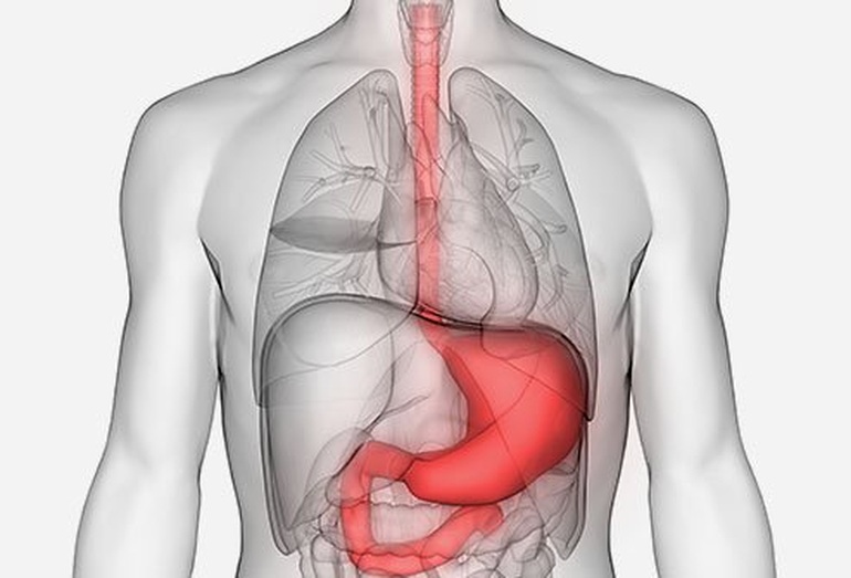 Dễ nhầm lẫn các triệu chứng của ung thư dạ dày và viêm loét dạ dày - 1
