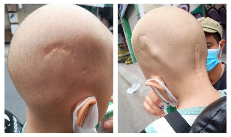 Con đã kiên trì chịu đựng bao đau đớn, mẹ sao nỡ buông tay - 3 Con đã kiên trì chịu đựng bao đau đớn, mẹ sao nỡ buông tay - 3