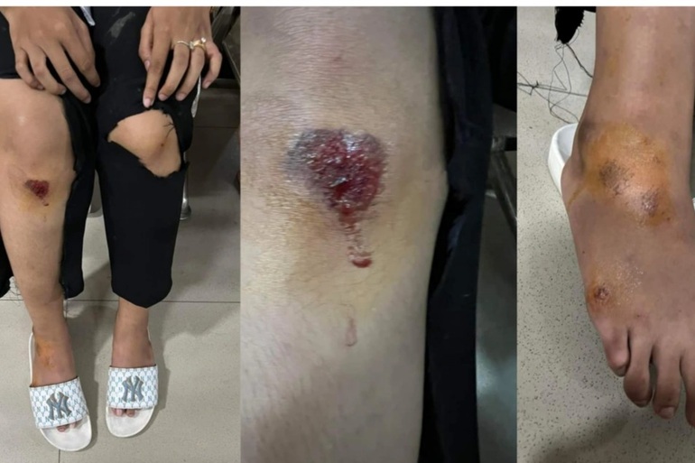 Nữ sinh tung chưởng hạ gục hai tên cướp điện thoại trên đường - 2 Nữ sinh tung chưởng hạ gục hai tên cướp điện thoại trên đường - 2