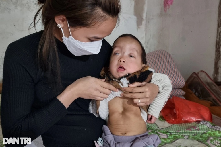 Tiếng khóc xé lòng của bé 21 tháng tuổi bị trời hành vật vã đau đớn - 3