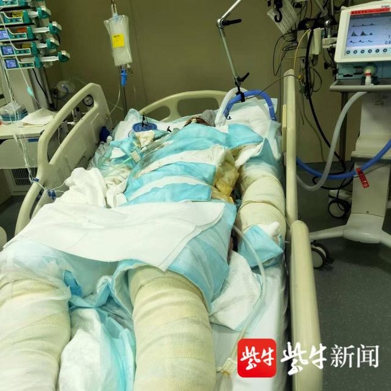 Người chồng giữ chặt vợ ngoài ban công mặc lửa cháy sau lưng vừa qua đời - 1