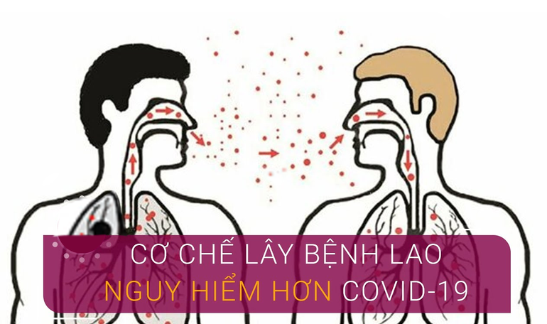 Quản lý điều trị người bệnh lao các tuyến kết hợp dự phòng Covid-19 - 2 Quản lý điều trị người bệnh lao các tuyến kết hợp dự phòng Covid-19 - 2