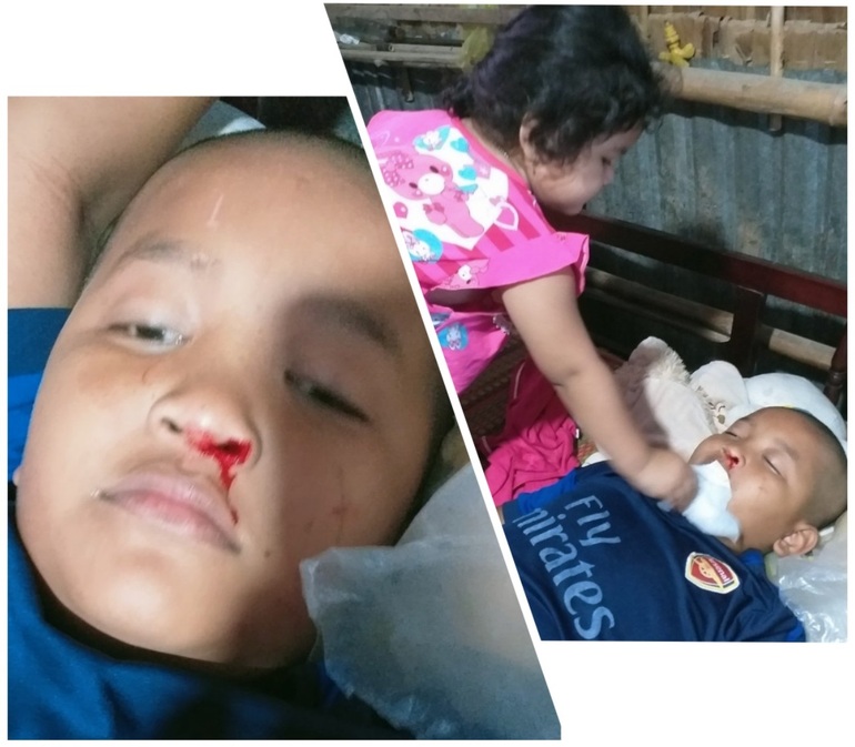 Thương cậu bé Khmer suýt chết mấy lần vì không có tiền chữa bệnh - 2