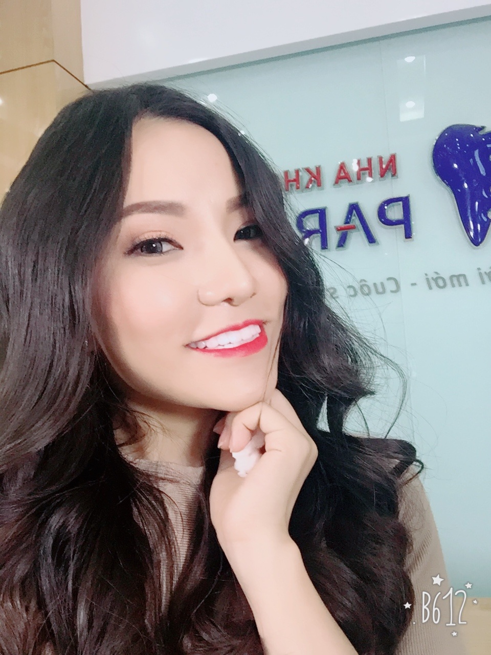 Giới trẻ "mê mẩn" trào lưu bọc răng sứ Nano Shining 5S - 3 Lý Phương Châu làm răng sứ nano shining 5s tại nha khoa Paris