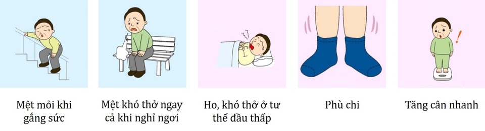 Suy tim - chặng đường cuối nhọc nhằn của các bệnh tim mạch - 2 Các dấu hiệu điển hình của suy tim