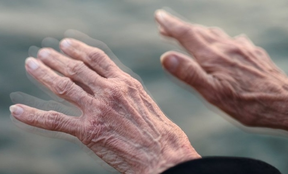 Thêm một phương pháp trong điều trị làm chậm tiến triển của bệnh Parkinson - 1 Bệnh Parkinson gây trở ngại lớn trong sinh hoạt cũng như công việc hàng ngày của người bệnh
