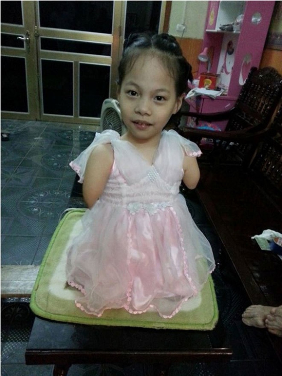 Linh Chi – cô bé Nick Vujicic của Việt Nam.