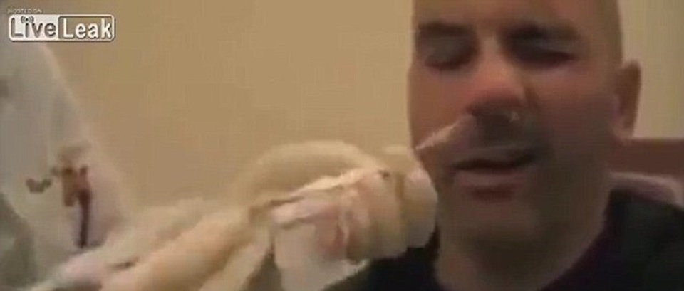 Kinh hãi cảnh lấy sán dây dài 1,5m qua mũi người đàn ông - 1 Trong video, khi bác sĩ kéo con sán từ lỗ mũi bên phải, người đàn ông bắt đầu rên rỉ trong đau đớn