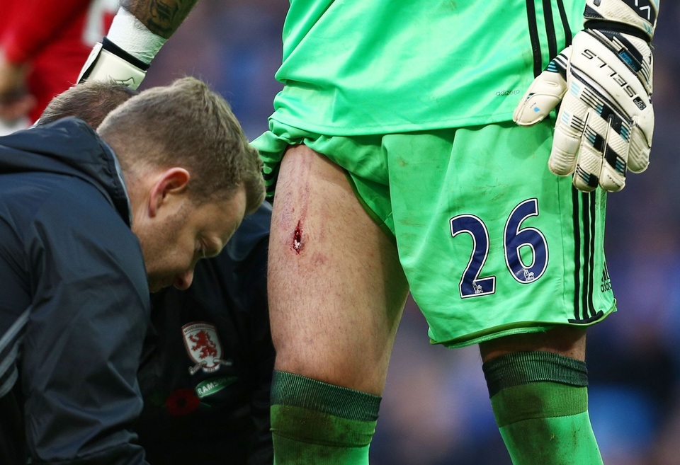 
Hậu quả, thủ thành của đội khách bị rách đùi. Đinh giày của Navas đã đục một lỗ trên đùi của Valdes
