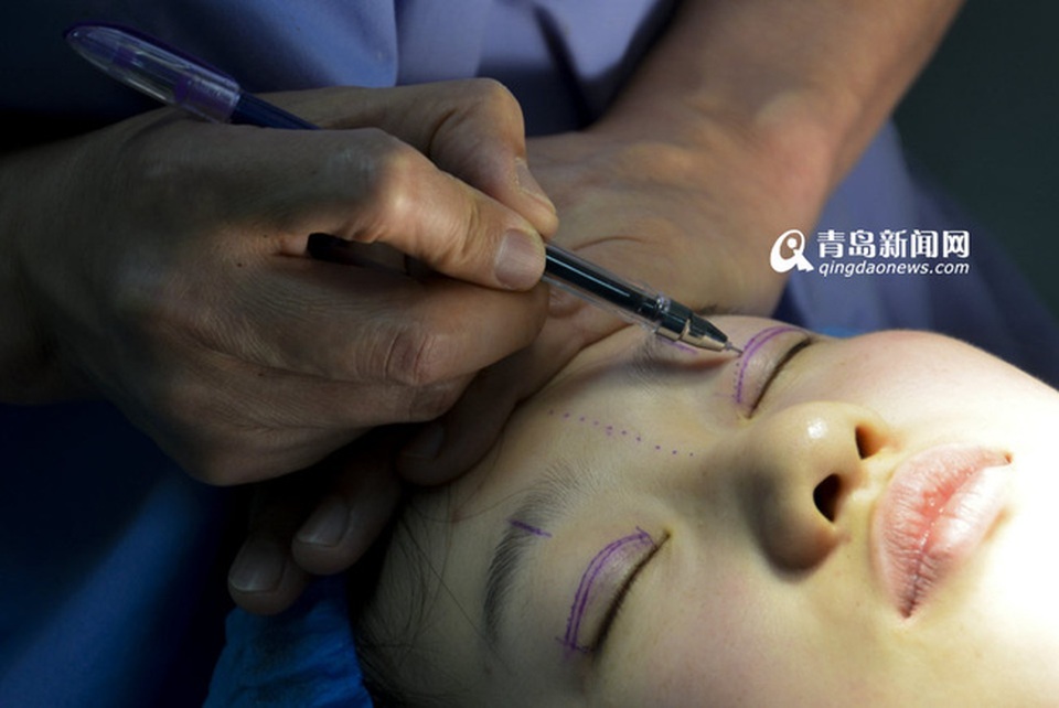 Cô gái 19 tuổi phẫu thuật thẩm mỹ để trở thành bản sao của Lưu Diệc Phi - 5
Lý Dịch Phi phẫu thuật thẩm mỹ bất chấp sự phản đối của cha mẹ.