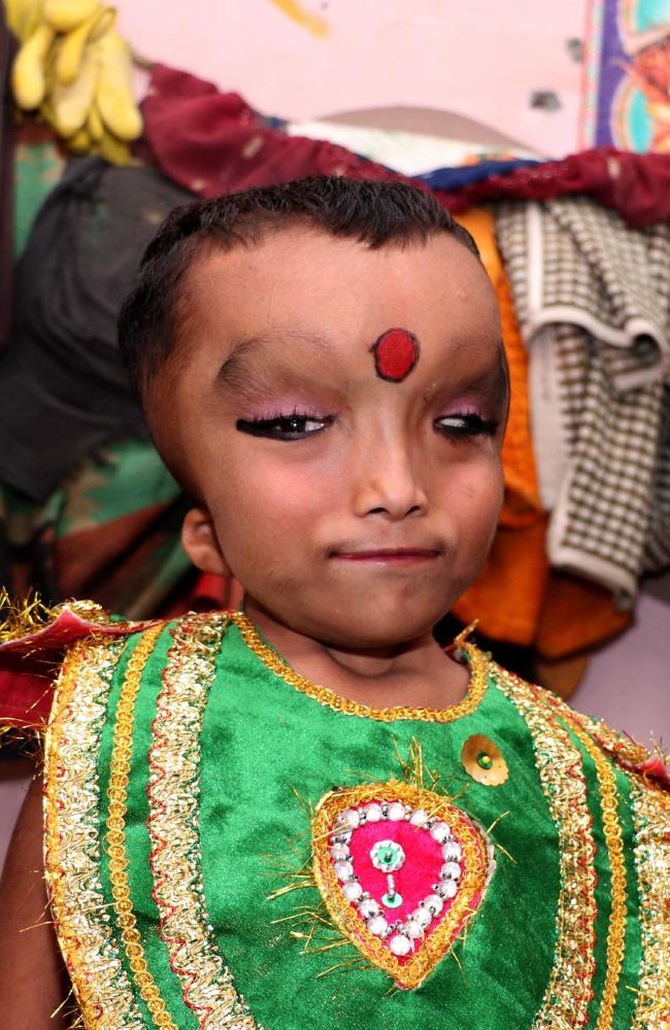 Cậu bé dị dạng được tôn làm "thánh thần" - 3