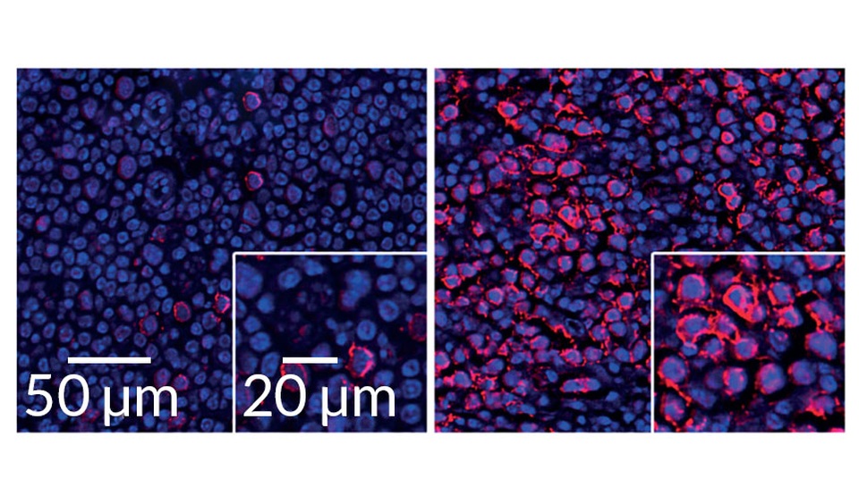 Virus kích hoạt các protein miễn dịch để trợ giúp kẻ thù - 1
Protein interferon type 1 là nguyên nhân gây tổn thất các tế bào B, sản xuất ra kháng thể đặc hiệu với virus cần chiến đấu.