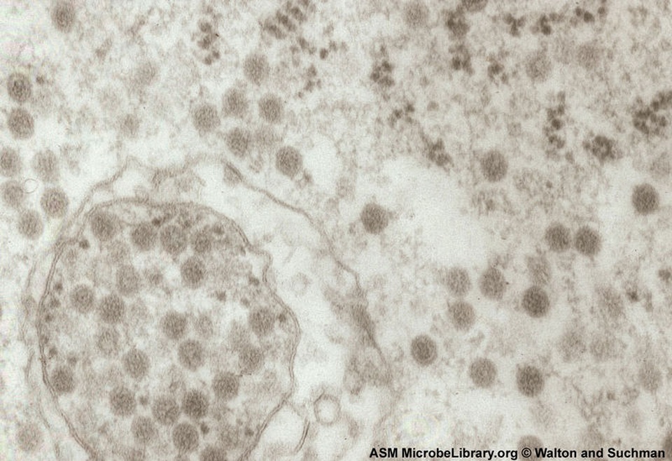 Giải mã một virus gây chết người - 1 Giải mã một virus gây chết người - 1