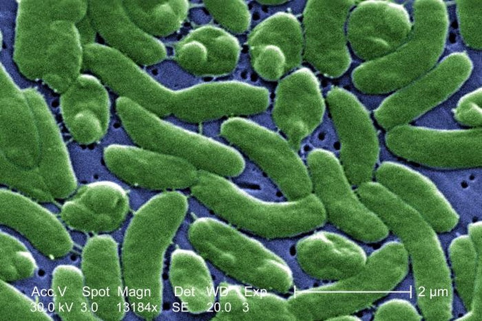 Vi khuẩn Vibrio Vulnificus từ đại dương gây ra chết người - 1
Một hình ảnh chụp hiển vi điện tử của vi khuẩn Vibrio vulnificus.