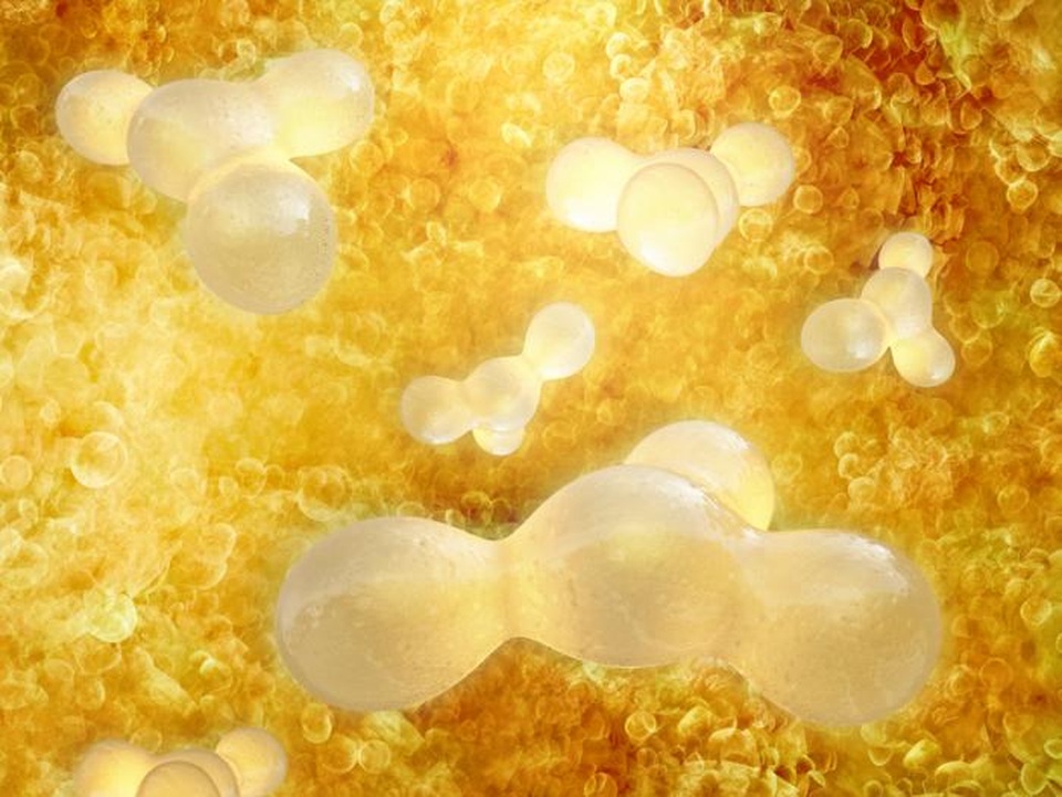 "Tấn công" gen mỡ trắng – Hướng tiếp cận điều trị béo phì mới - 1 Khi các tế bào mỡ trắng chứa đầy các phân tử chất béo, béo phì có thể xảy ra.