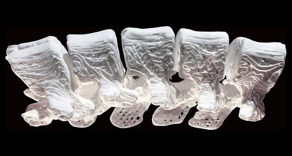 Xương được in bằng công nghệ 3D tạo ra bước phát triển mới - 1 Khung xương được in bằng công nghệ 3D có tính mềm dẻo cao được sử dụng để chữa những xương bị gãy hoặc bị hư hỏng.
