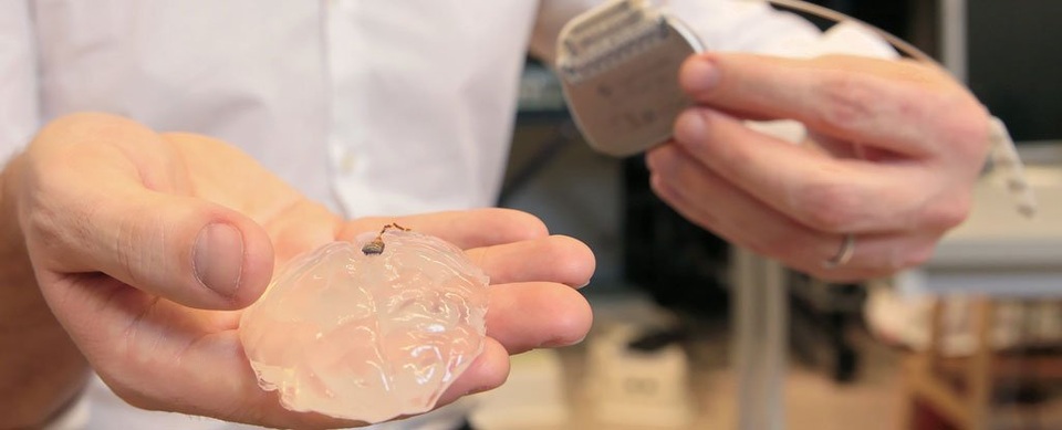 Mô cấy não không dây lần đầu tiên khôi phục khả năng đi lại - 1