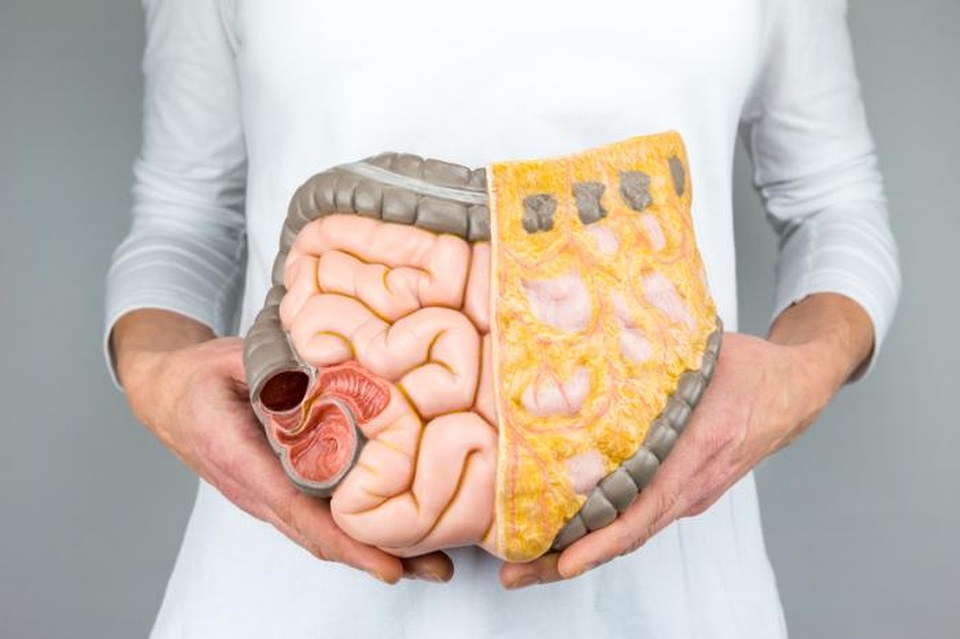 Phụ gia thực phẩm có thể gây ra ung thư đại trực tràng - 1 Phụ gia thực phẩm có thể gây ra ung thư đại trực tràng - 1