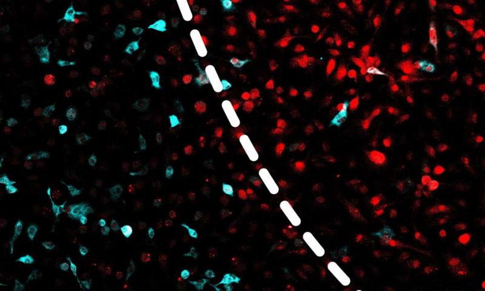 Công cụ mới sử dụng ánh sáng cực tím để kiểm soát tình trạng viêm - 1
