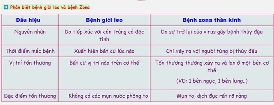 Cách phân biệt vết zona thần kinh, "giời leo" và kiến ba khoang cắn - 3 Cách phân biệt vết zona thần kinh, "giời leo" và kiến ba khoang cắn - 3