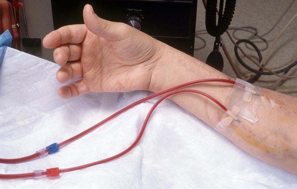 7 biến chứng thường gặp khi không điều trị tiểu đường "đến nơi đến chốn" - 3