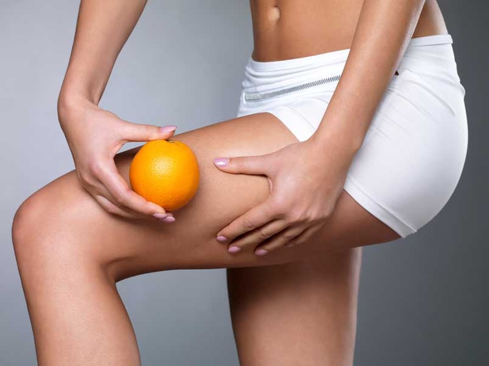 Có thể trị bệnh da sần vỏ cam? - 1 Có thể trị bệnh da sần vỏ cam? - 1