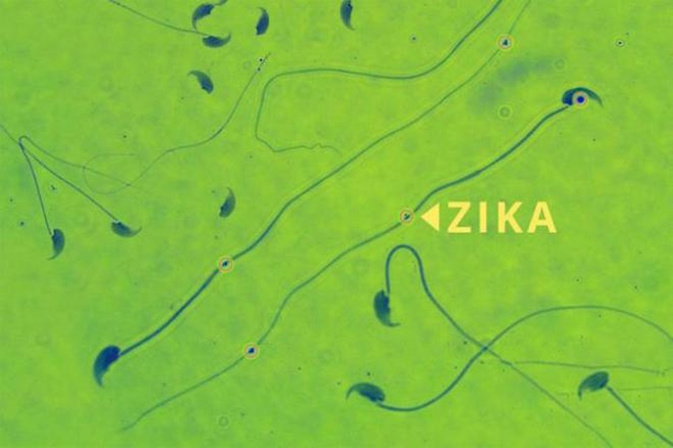 Vi rút Zika có thể gây teo tinh hoàn? - 1 Nghiên cứu mới phát hiện ra Zika ảnh hưởng đến khả năng sinh sản của chuột đực