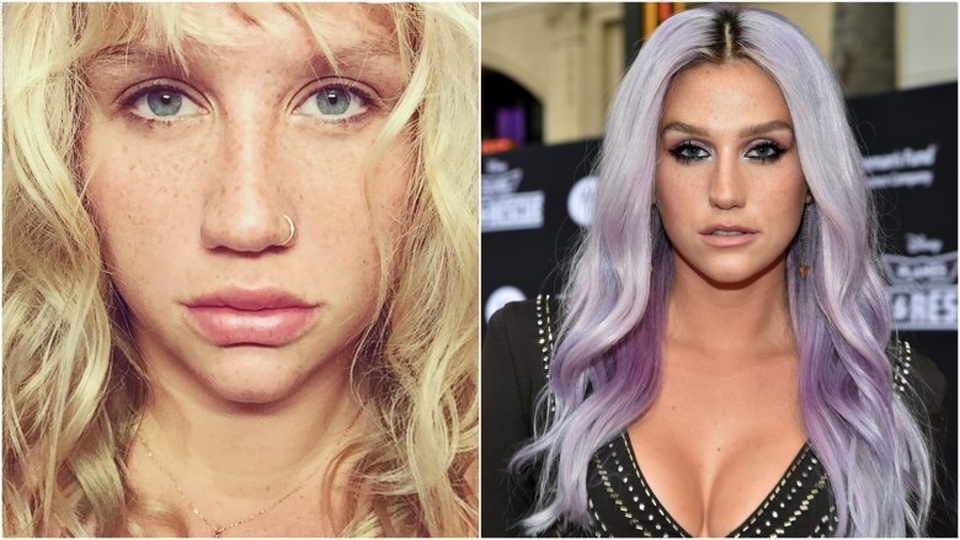 “Sao” quá khác lạ khi không trang điểm - 15
Kesha