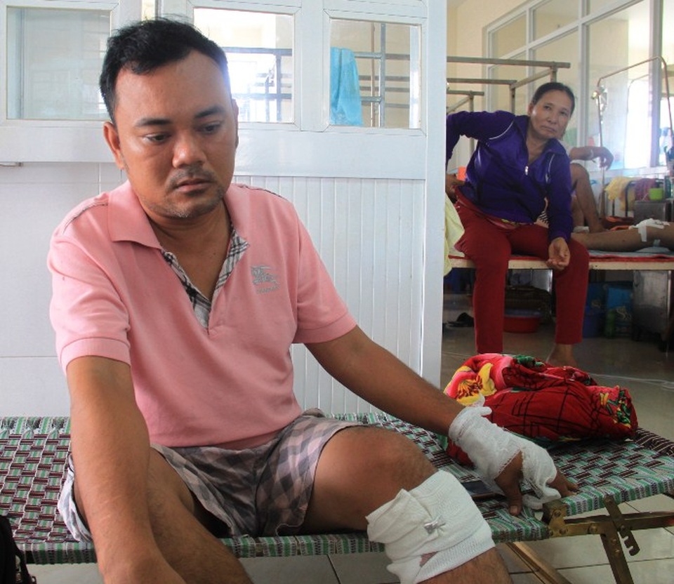 Phá giá chở khách, chủ xe bị đánh trọng thương? - 1
Ông Vương với vết thương ở chân, tay do nghi bị con trai cán bộ Phòng y tế huyện Phù Mỹ hành hung