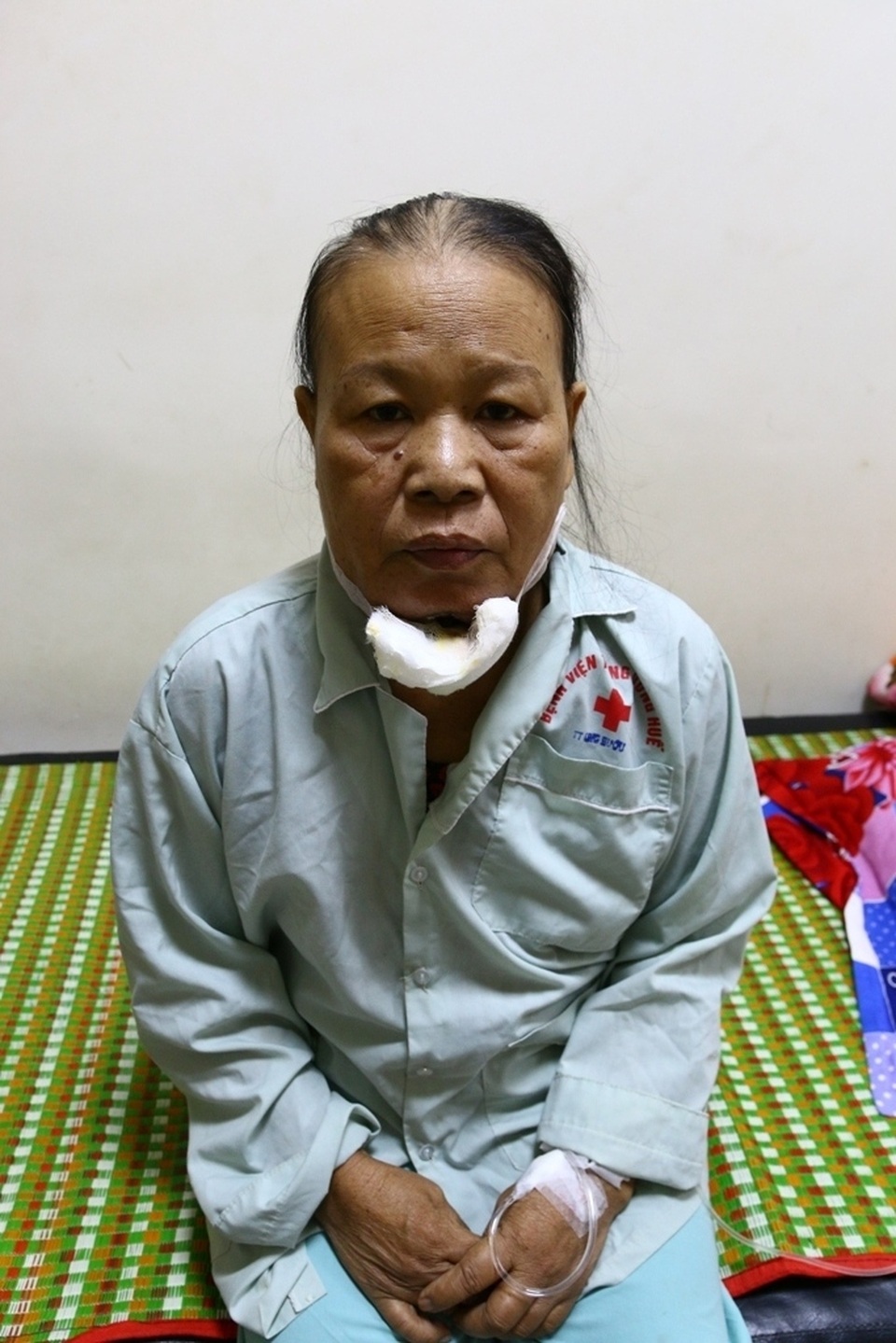 Cảm phục cảnh con rể chăm sóc mẹ bị ung thư bên giường bệnh - 1 Dì Huỳnh Thị Lợi, 53 tuổi đang nằm tại phòng 308, Trung tâm Ung bướu, bệnh viện Trung ương Huế