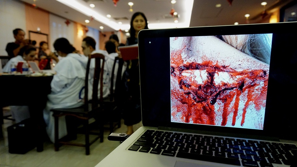 Chủ đề lần này là “Vết sẹo”