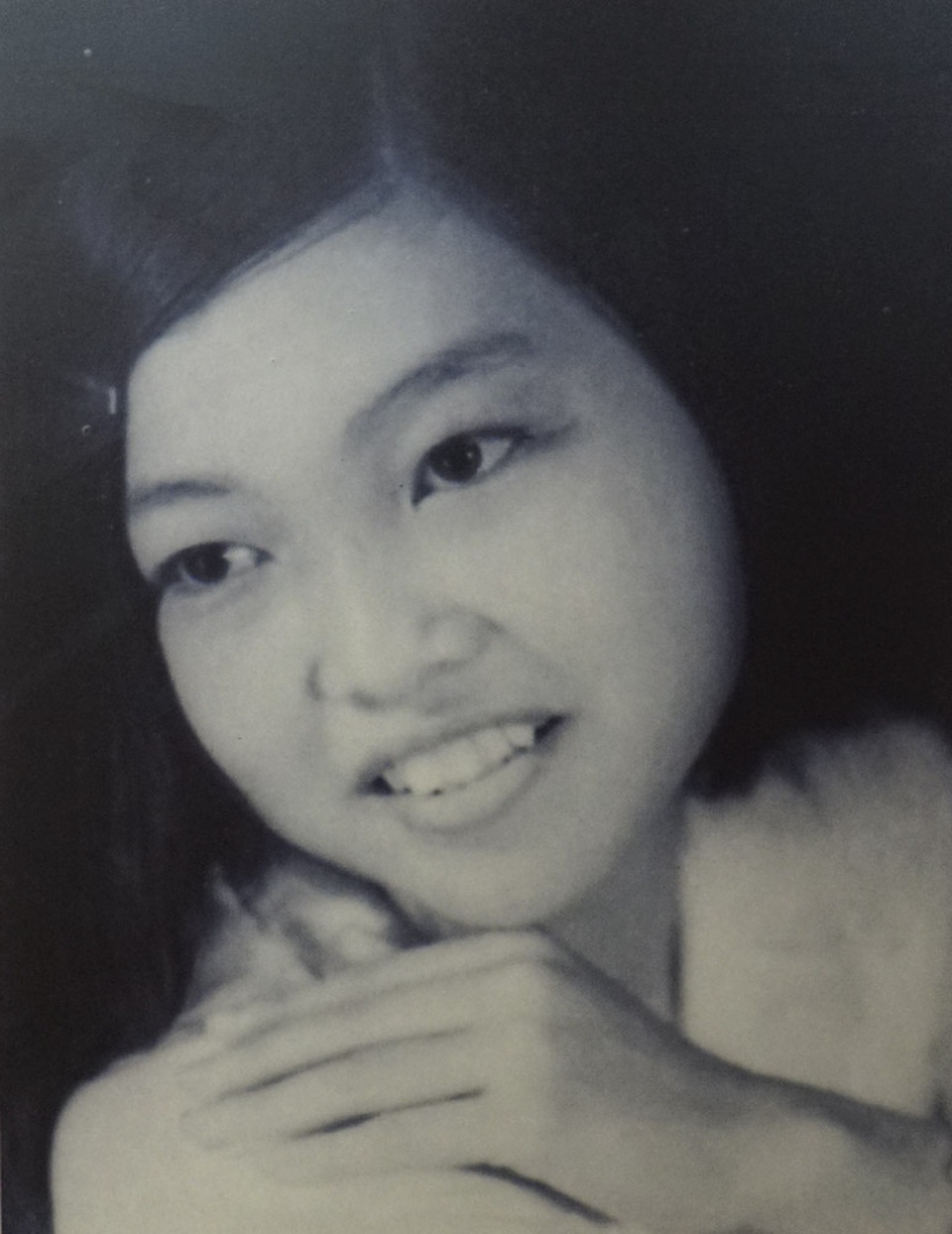 Những hình ảnh, kỷ vật "đi qua cuộc chiến" - 9 Bà Nguyễn Ngọc Giới, sinh năm 1958, thương binh 3/4 - Bến Tre. Năm 1972 lúc đang làm giao liên tại bốt Địa Nhưỡng (Mỏ Cày - Bến Tre) bà Giới bị mảnh pháo găm trúng người, ngất lịm. Tỉnh dậy bà thấy chân phải mình lủng lẳng, nhìn ra sau mới biết xương đùi bị gãy thành 2 đoạn, sau đó được đồng đội đưa đi cấp cứu, toàn thân băng bó đến nỗi mẹ của bà đã không nhận ra. Trải qua 3 lần phẫu thuật, may mắn bà vẫn đi lại được dù chân thấp chân cao.