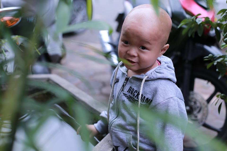 Cậu bé Lanh dễ thương trở lại cơ quan Dân trí sau ca phẫu thuật và 5 lần truyền hóa chất.