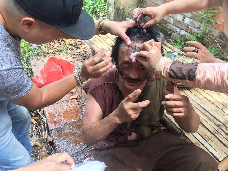 Nghệ sĩ Giang "còi" đóng Chí Phèo phiên bản mới - 2 Nghệ sĩ Giang còi bị bạn diễn lỡ tay gây tai nạn khiến đạo diễn và ê-kíp phải sơ cứu ngay tại phim trường.