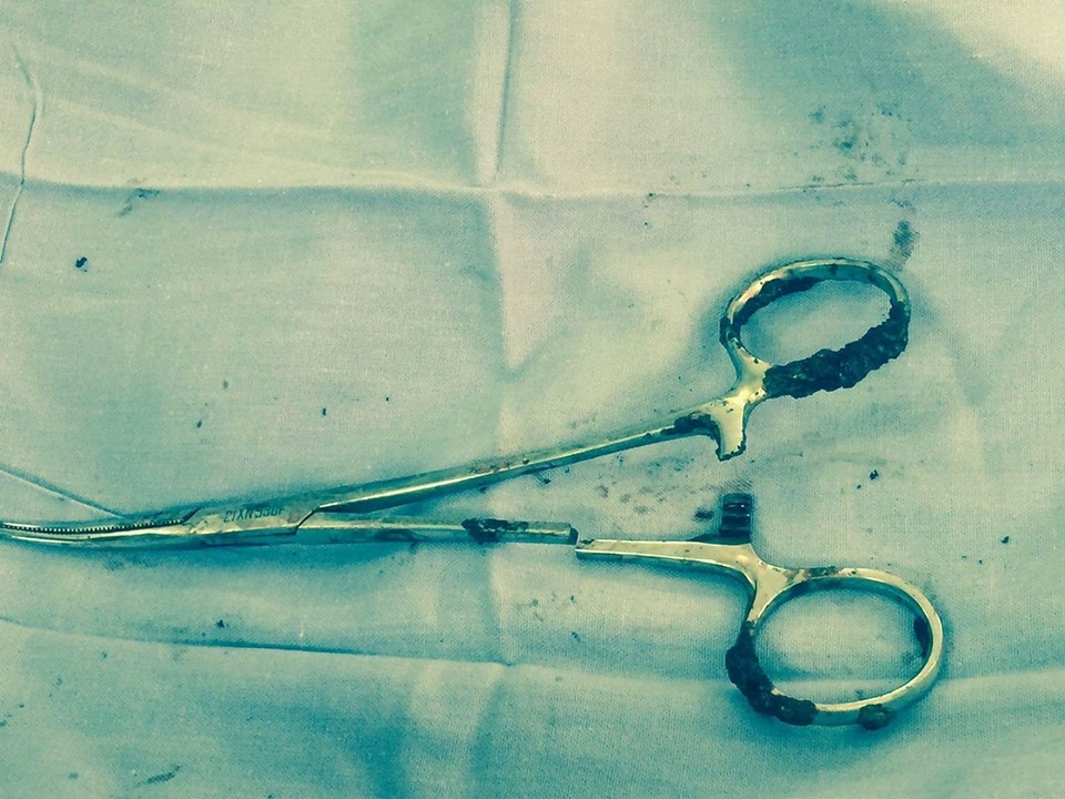 Bộ Y tế thăm bệnh nhân bị quên panh phẫu thuật trong bụng 18 năm - 2