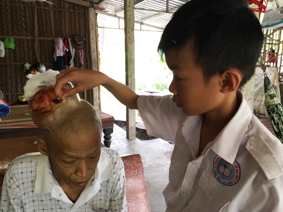 Thương bé lớp 7 chăm cả cha và mẹ đều mắc bệnh ung thư - 1 Mỗi ngày khi đi học về Quang thường chăm sóc vết thương cho cha