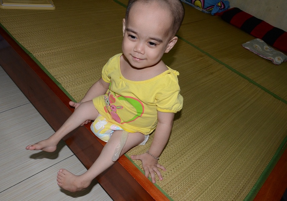 Thương 2 chị em mắc đa dị tật, suy giảm miễn dịch bẩm sinh - 2
Dù mang trong mình biết bao thứ bệnh, nhưng con rất ngoan, rất hay nói cười. Nhìn con mà chúng tôi ai cũng thấy lòng quặn thắt
