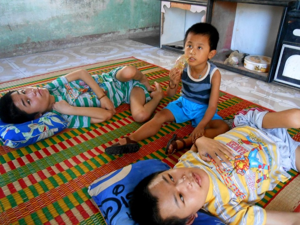 Mẹ đau đớn chứng kiến 3 con lần lượt bị bại liệt - 2 Cả 3 con đều mắc bệnh teo cơ, rút chân tay, 2 cháu lớn phải nằm liệt một chỗ, cháu út bảy tuổi nhưng không nói được và chân tay cũng đang dần tay rút như 2 anh