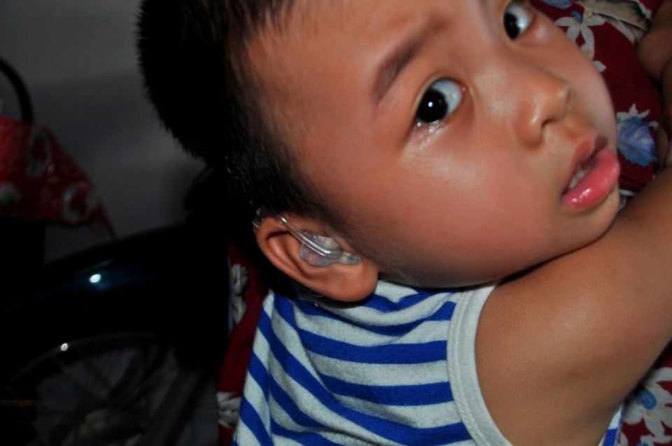 Xót thương cháu bé 2 tuổi bị tổn thương não và mất thính lực nặng - 2 Hiện cháu phải đeo máy trợ thính nhưng cũng không nghe được gì nhiều vì cháu mất thính lực nặng ở cả hai tai