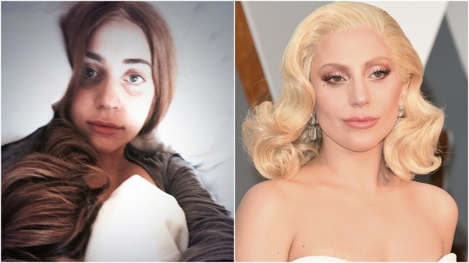 “Sao” quá khác lạ khi không trang điểm - 10
Lady Gaga